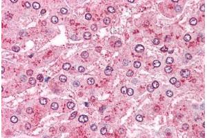 Human Liver: Formalin-Fixed, Paraffin-Embedded (FFPE) (ERAP1 antibody  (Internal Region))