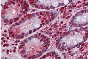 Human Small Intestine: Formalin-Fixed, Paraffin-Embedded (FFPE) (HDAC1 antibody  (AA 1-483))