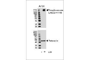 Western blot analysis of lysates from A431 cell line, untreated or treated with EGF, 100 ng/mL, using Phospho-mouse ERBB2- q (upper) or Beta-actin (lower). (ErbB2/Her2 antibody  (pTyr1140))