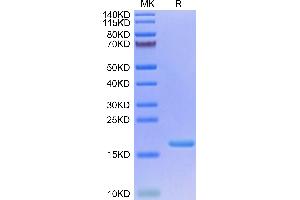 Biotinylated Human IL-3 on Tris-Bis PAGE under reduced condition. (IL-3 Protein (AA 20-152) (His-Avi Tag,Biotin))