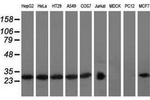 Western blot analysis of extracts (35 µg) from 9 different cell lines by using anti-RABL2A monoclonal antibody. (RABL2A antibody)