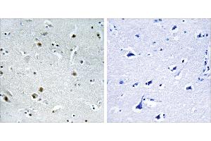 Peptide - +Immunohistochemistry analysis of paraffin-embedded human brain tissue using DDX24 antibody. (DDX24 antibody)