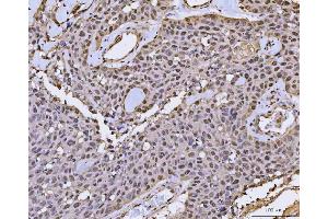 IHC analysis of FIP1L1 using anti-FIP1L1 antibody (ABIN7600761). (FIP1L1 antibody  (AA 23-558))