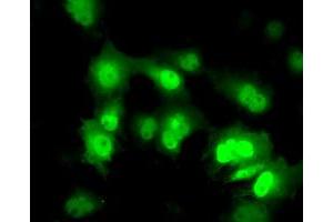 Anti-PPME1 mouse monoclonal antibody (ABIN2453495) immunofluorescent staining of COS7 cells transiently transfected by pCMV6-ENTRY PPME1 (RC200009). (PPME1 antibody)