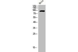 Western Blot analysis of HELA cells using Adducin α/β Polyclonal Antibody (alpha Adducin antibody)