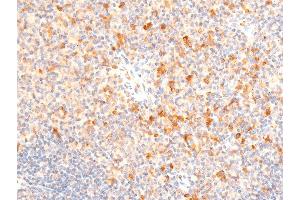 Immunohistochemistry (IHC) image for anti-serum/glucocorticoid Regulated Kinase 1 (SGK1) (pSer422) antibody (ABIN6256329)