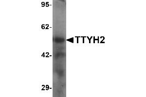 Western blot analysis of TTYH2 in human kidney tissue lysate with TTYH2 antibody at 1 µg/mL (TTYH2 antibody  (N-Term))
