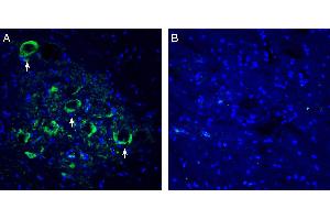 Expression of Connexin-47 in rat spinal cord ventral horn region. (GJC2 antibody  (AA 100-111))