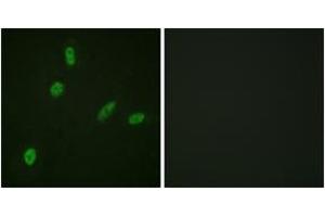 Immunofluorescence analysis of HeLa cells, using ETS1 (Ab-38) Antibody.