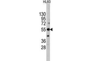 Image no. 1 for anti-Intestinal Alkaline Phosphatase (ALPI) (Center) antibody (ABIN356999) (Intestinal Alkaline Phosphatase antibody  (Center))