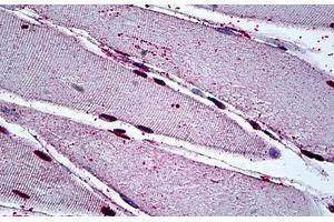 Human Skeletal Muscle: Formalin-Fixed, Paraffin-Embedded (FFPE) (MEOX2 antibody  (AA 1-304))