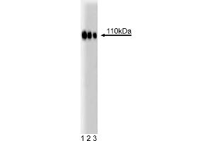 Western Blotting (WB) image for anti-Espin (ESPN) (AA 458-580) antibody (ABIN968627) (Espin antibody  (AA 458-580))