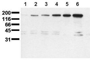 Western Blotting (WB) image for anti-Receptor tyrosine-protein kinase erbB-2 (ErbB2/Her2) (pSer1113) antibody (ABIN126790) (ErbB2/Her2 antibody  (pSer1113))