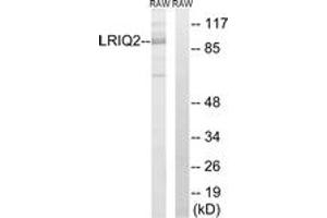 Western Blotting (WB) image for anti-Centrosomal Protein 97kDa (CEP97) (AA 581-630) antibody (ABIN2890391) (CEP97 antibody  (AA 581-630))