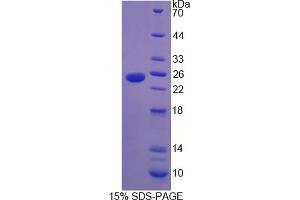 Image no. 1 for Heat Shock 27kDa Protein Family, Member 7 (Cardiovascular) (HSPB7) (AA 1-170) protein (His tag) (ABIN4989841)