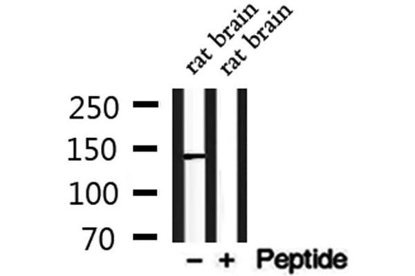 CADPS2 antibody  (N-Term)