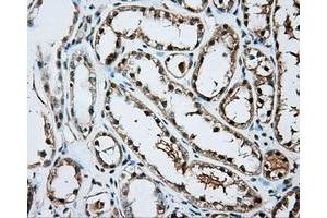 Immunohistochemical staining of paraffin-embedded Kidney tissue using anti-ARNT mouse monoclonal antibody. (ARNT antibody)