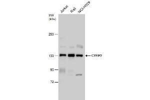 WB Image CYFIP2 antibody detects CYFIP2 protein by western blot analysis. (CYFIP2 antibody)