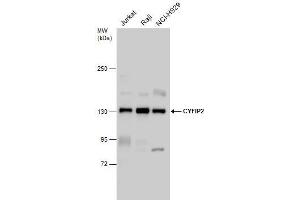 WB Image CYFIP2 antibody detects CYFIP2 protein by western blot analysis. (CYFIP2 antibody)