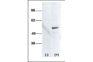 Western blot analysis of anti-STK38L Pab transiently transfected HEK-293 cell line lysate (1ug/lane). (STK38L antibody  (C-Term))