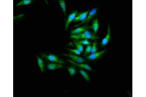Immunofluorescence staining of Hela cells with ABIN7160013 at 1:266, counter-stained with DAPI. (JNK2 antibody  (AA 1-424))