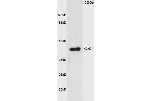 Lane 1: mouse kidney lysates probed with Anti PTGER1 Polyclonal Antibody, Unconjugated (ABIN872820) at 1:200 in 4 °C. (PTGER1 antibody  (AA 61-160))