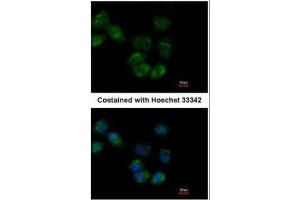 ICC/IF Image Immunofluorescence analysis of paraformaldehyde-fixed A431, using HSP70 1L, antibody at 1:500 dilution. (HSPA1L antibody  (Center))