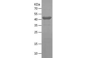 Western Blotting (WB) image for Intercellular Adhesion Molecule 1 (ICAM1) (AA 26-272) protein (His-IF2DI Tag) (ABIN7283511) (ICAM1 Protein (AA 26-272) (His-IF2DI Tag))