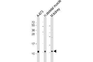 All lanes : Anti-NDUFA1 Antibody (Center) at 1:2000 dilution Lane 1: A-673 whole cell lysate Lane 2: human skeletal muscle lysate Lane 3: mouse kidney lysate Lysates/proteins at 20 μg per lane. (NDUFA1 antibody  (AA 26-59))
