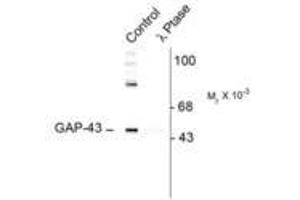 Image no. 1 for anti-Growth Associated Protein 43 (GAP43) (pSer41) antibody (ABIN227321) (GAP43 antibody  (pSer41))