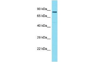 Host: Rabbit Target Name: ZYG11A Sample Type: Hela Whole Cell lysates Antibody Dilution: 1. (ZYG11A antibody  (C-Term))