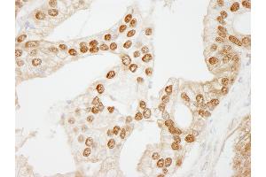 Immunohistochemistry (IHC) image for anti-WD Repeat Domain 77 (WDR77) (AA 292-342) antibody (ABIN7449034) (WDR77 antibody  (AA 292-342))