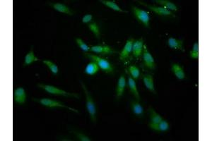 Immunofluorescence staining of Hela cells with ABIN7158776 at 1:166, counter-stained with DAPI. (PRCP antibody  (AA 347-443))