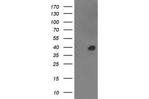 HEK293T cells were transfected with the pCMV6-ENTRY control (Left lane) or pCMV6-ENTRY ANKRD53 (Right lane) cDNA for 48 hrs and lysed. (ANKRD53 antibody  (AA 1-300))