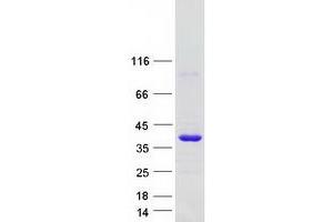 Validation with Western Blot