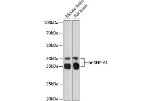 Western blot analysis of extracts of various cell lines, using hnRNP  Rabbit mAb (1564) at 1:1000 dilution. (HNRNPA1 antibody)