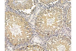 ABIN7096225 and ABIN7100287 at 1/100 staining rat testis tissue by IHC-P. (DSCR3 antibody)