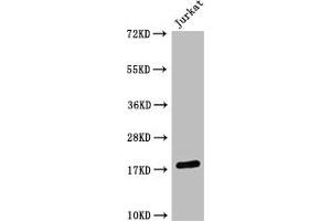 Western Blot Positive WB detected in: Jurkat whole cell lysate HistonC1 antibody at 1:1000 Secondary Goat polyclonal to mouse IgG at 1/50000 dilution Predicted band size: 15-25 KDa Observed band size: 15-25 KDa Exposure time:5 min (Histone 3 antibody  (H3K4me2))