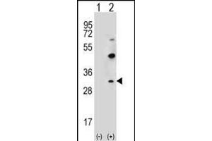 Western blot analysis of CLDN2 (arrow) using rabbit polyclonal CLDN2 Antibody  (ABIN656563 and ABIN2845823). (Claudin 2 antibody  (C-Term))
