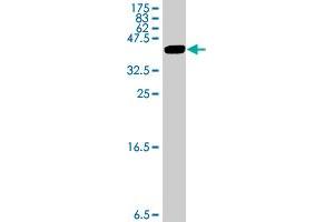 Western Blot detection against Immunogen (33. (MAGEA3 antibody  (AA 44-114))