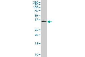 GYG1 monoclonal antibody (M07), clone 3B5. (Glycogenin 1 antibody  (AA 1-73))