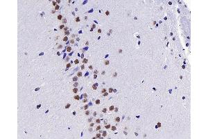 Immunohistochemistry analysis of paraffin-embedded Rat brain using c-Fos Polyclonal Antibody at dilution of 1:200. (c-FOS antibody)