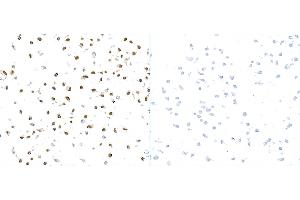 Immunocytochemistry (ICC) image for anti-gamma Histone Variant H2AX (GAMMA-H2AX) (Ser140) antibody (ABIN7449557) (gamma H2AX antibody  (Ser140))