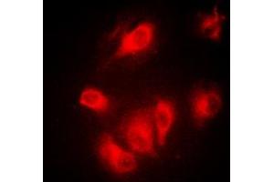 Immunofluorescent analysis of Aurora A staining in MCF7 cells.