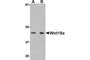 Western blot analysis of Wnt10a in RAW264. (WNT10A antibody  (C-Term))