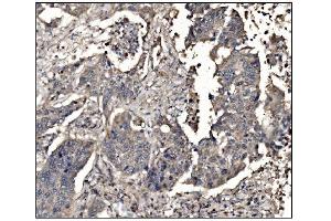 IHC analysis of DHPS/DHS using anti-DHPS/DHS antibody (ABIN7601998).