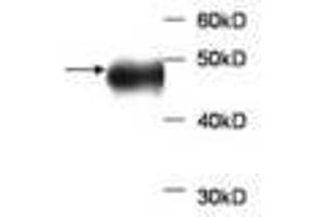 Image no. 1 for anti-Aldolase B, Fructose-Bisphosphate (ALDOB) antibody (ABIN791520) (ALDOB antibody)