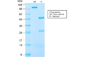 SDS-PAGE Analysis Purified IGF-1 Rabbit Recombinant Monoclonal Anitbody (IGF1/2872R). (Recombinant IGF1 antibody)