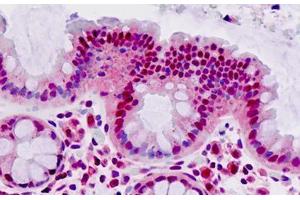 Human Colon: Formalin-Fixed, Paraffin-Embedded (FFPE) (MAT2A antibody  (AA 27-55))