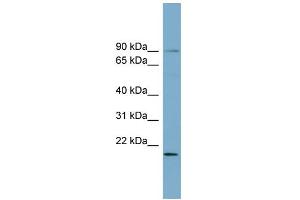 WB Suggested Anti-KIAA0776 Antibody Titration: 0. (UFL1 antibody  (Middle Region))